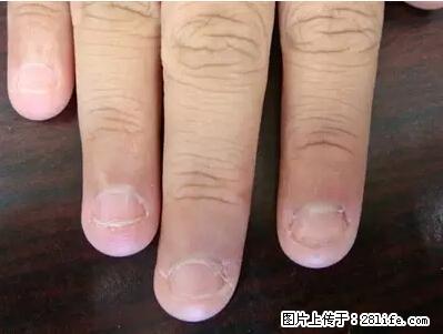 剪指甲、挖耳屎，这些日常小动作竟隐藏大危害！ - 金华生活资讯 - 金华28生活网 jh.28life.net